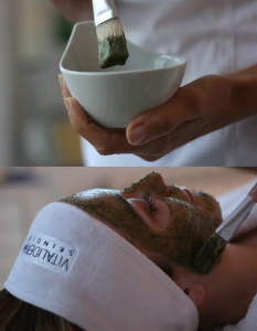 Tratamiento Biopeeling Vitalderma
